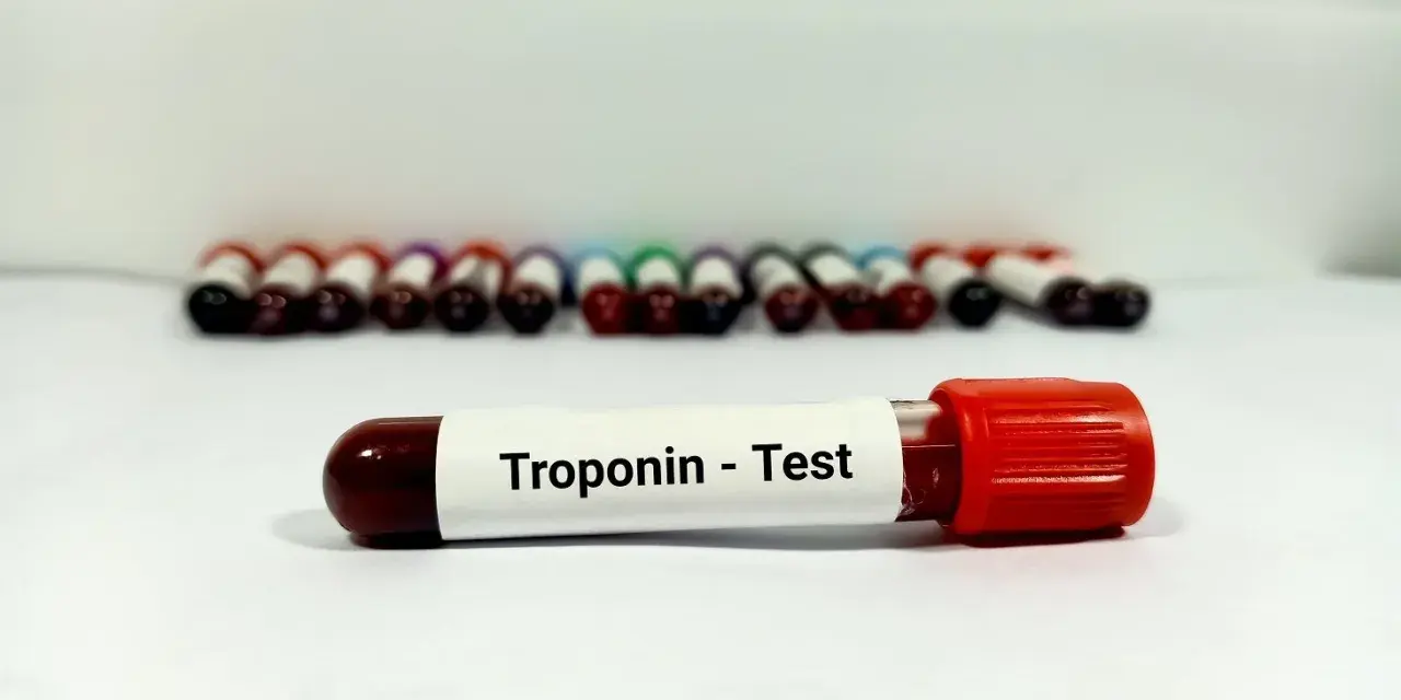 Probówka z oznaczeniem "Troponin - Test" na tle rzędu innych próbek krwi.