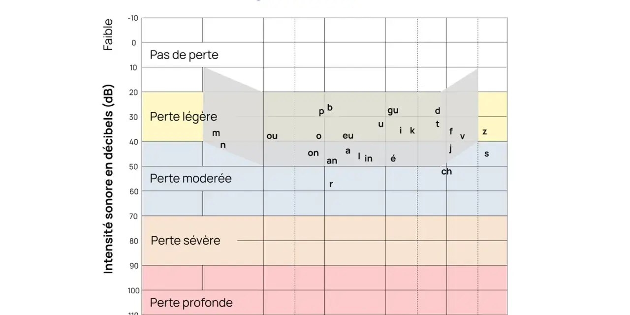 Audiogramme montrant les résultats d'un test auditif. Les zones indiquent le niveau de perte auditive, de "Pas de perte" à "Perte profonde", en fonction de la fréquence et de l'intensité sonore. Ce graphique est essentiel pour évaluer l'audition à tout...
