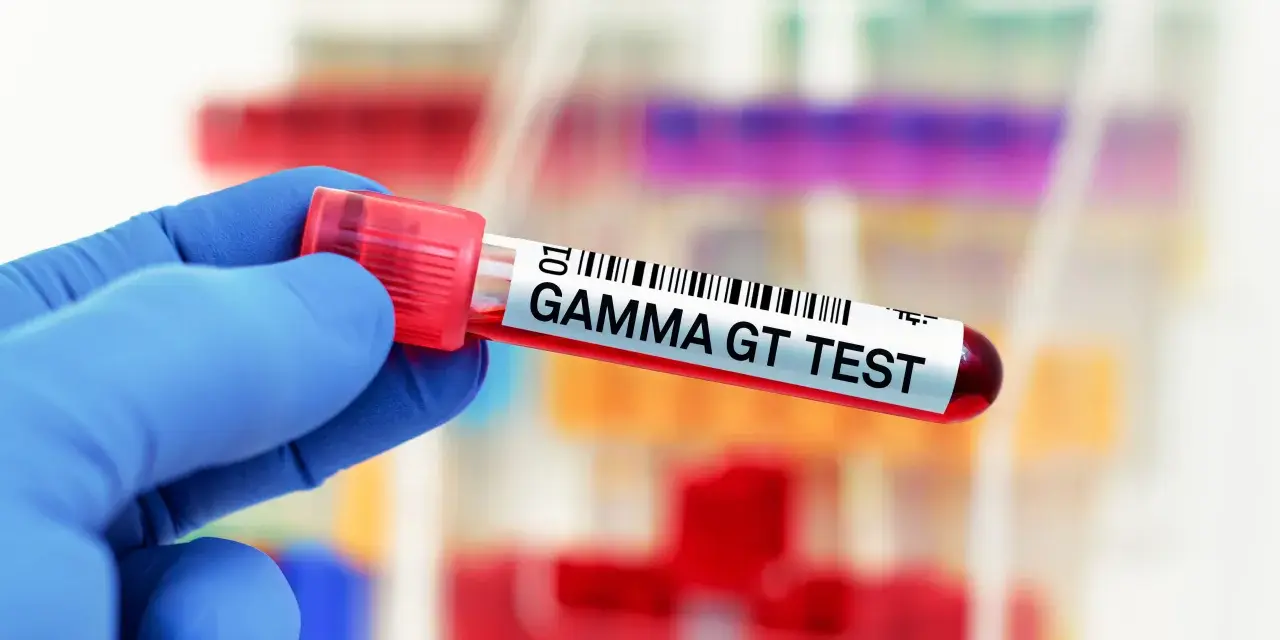 Ręka w niebieskiej rękawiczce trzyma probówkę z krwią oznaczoną "GAMMA GT TEST". To badanie ocenia poziom enzymu gamma-glutamylotranspeptydazy.