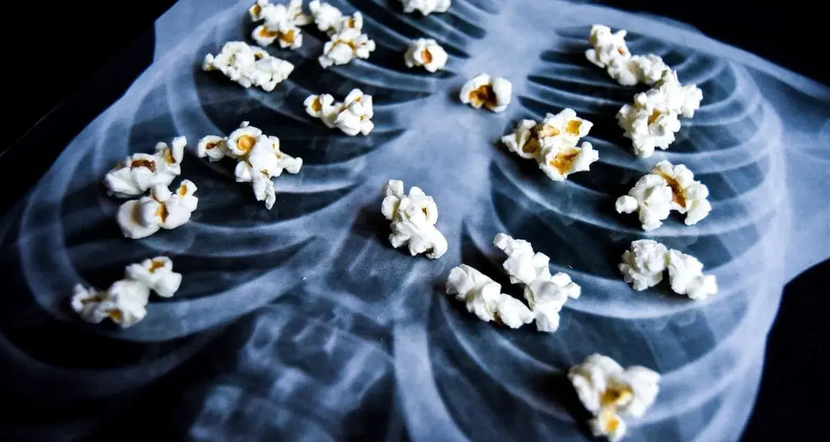 Palomitas de maíz sobre una radiografía de tórax, evocando el peligro del diacetilo en el vapeo.