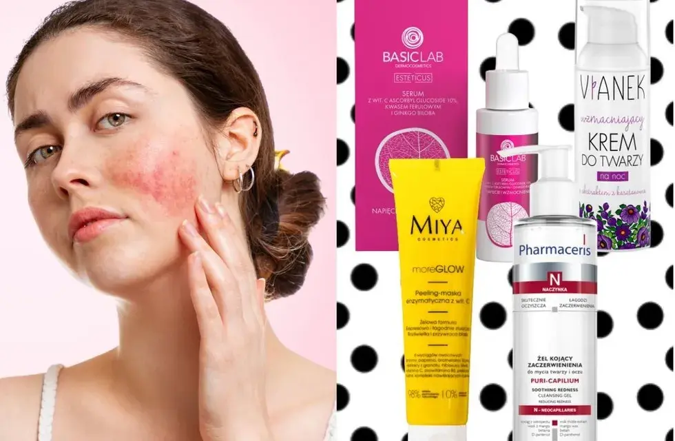 Peeling do cery naczynkowej: bezpieczne złuszczanie i wzmocnienie skóry