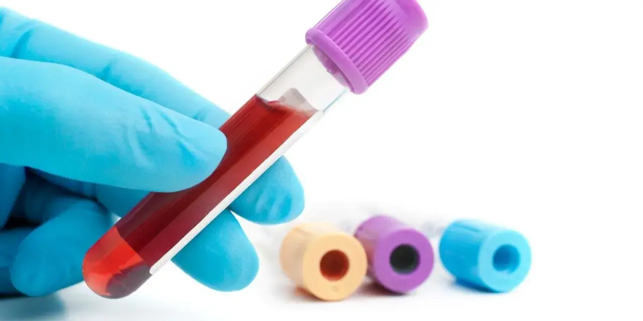 Ręka w niebieskiej rękawiczce trzyma probówkę z krwią do badania, np. hba1c. W tle inne probówki.