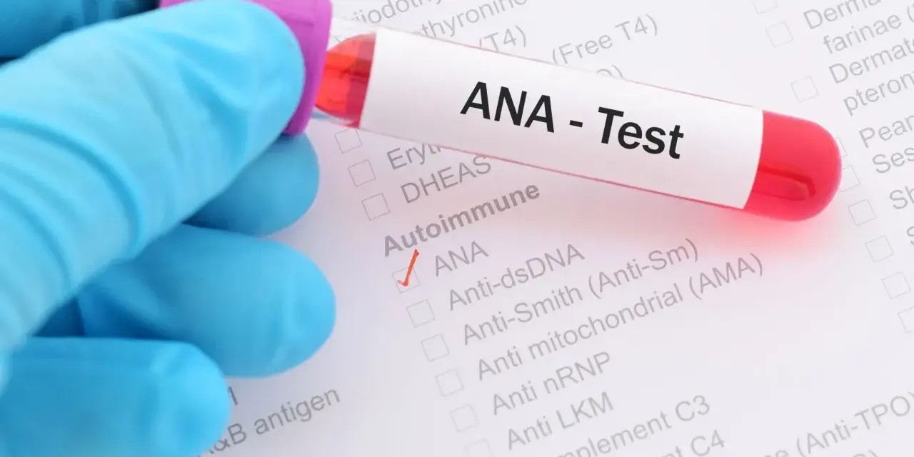 Ręka w niebieskiej rękawiczce trzyma probówkę z krwią do testu ANA. Na formularzu zaznaczono ANA.