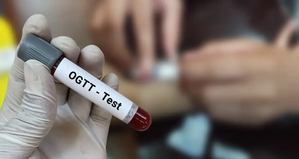 Ręka w rękawiczce trzyma probówkę z krwią z oznaczeniem "OGTT - Test". W tle widać proces pobierania krwi, kluczowy dla test obciążenia glukozą 75g interpretacja wyników.