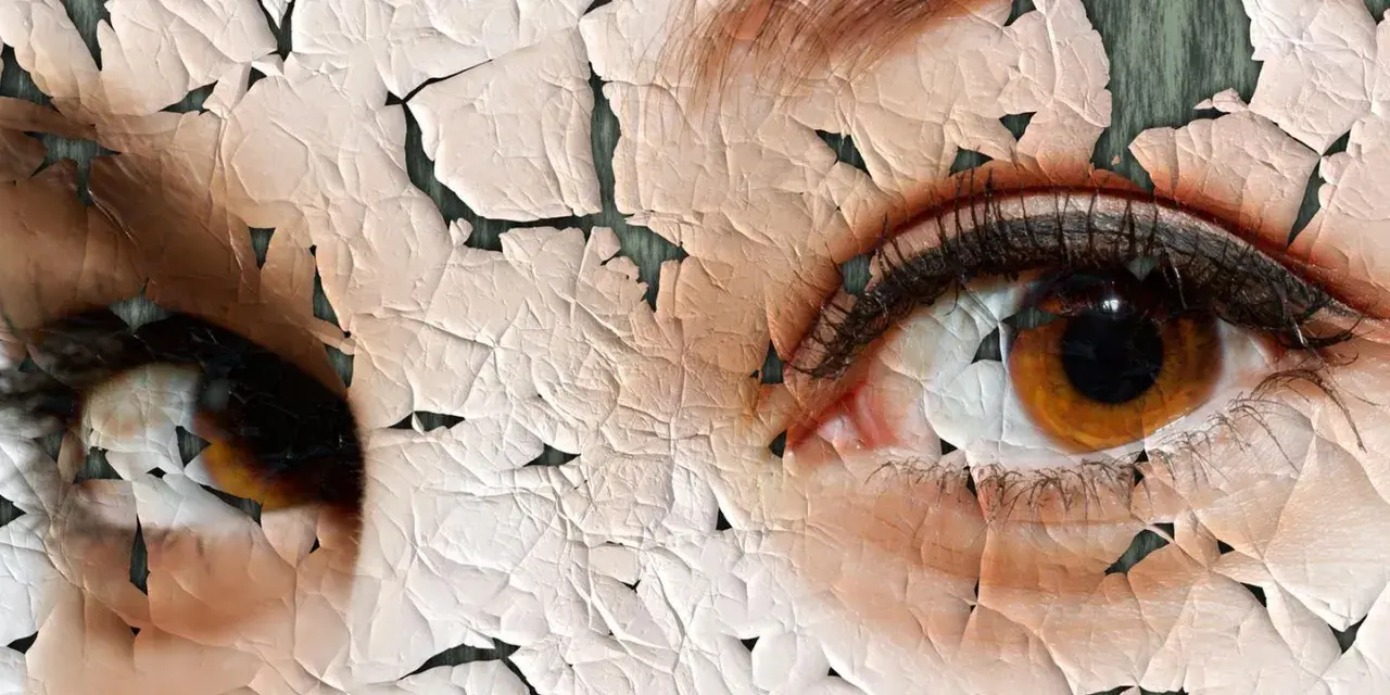 Nahaufnahme von Augen mit rissiger, schuppiger Haut.