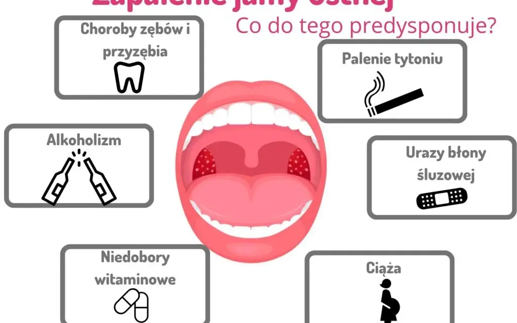 Skuteczne płukanki na stan zapalny jamy ustnej, które przynoszą ulgę