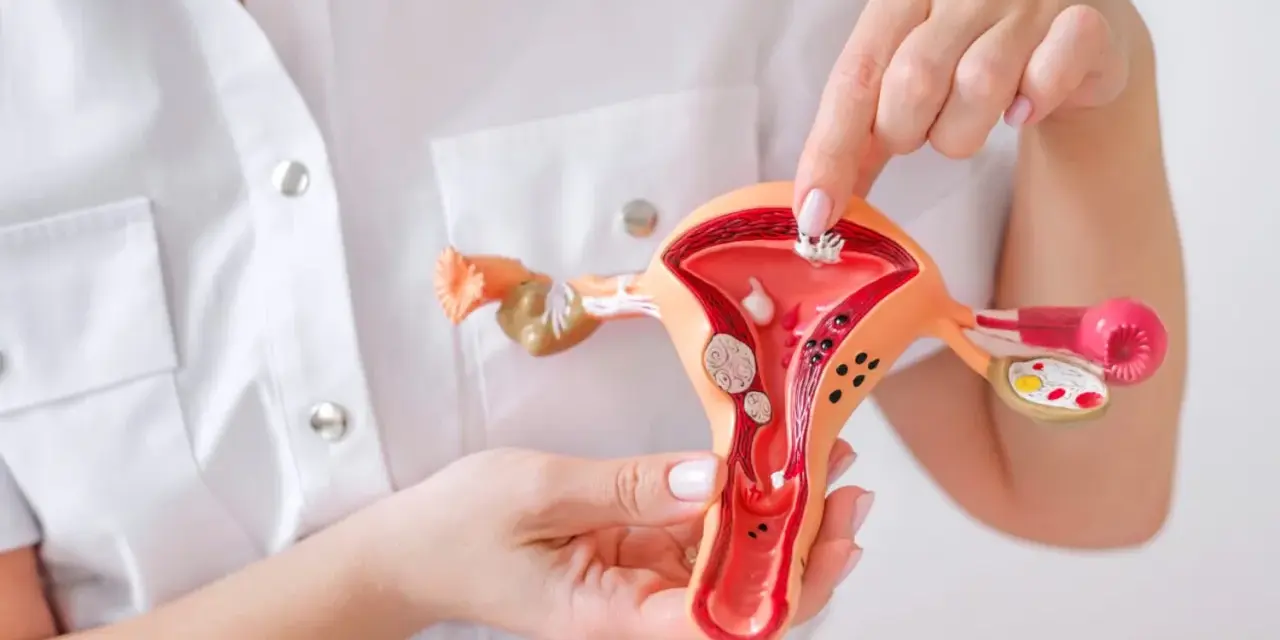 Model narządu rodnego kobiety z widocznymi mięśniakami i cienkim endometrium.