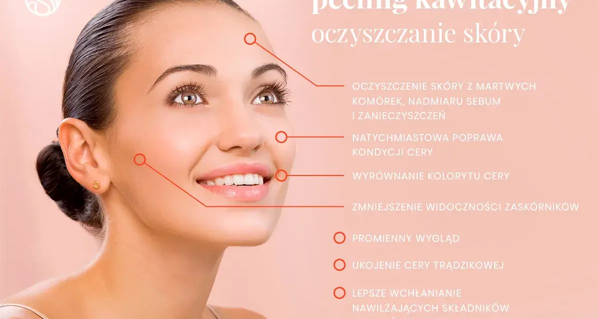 Peeling kawitacyjny to głębokie oczyszczanie skóry, które usuwa martwe komórki, sebum i zanieczyszczenia, poprawiając jej kondycję.