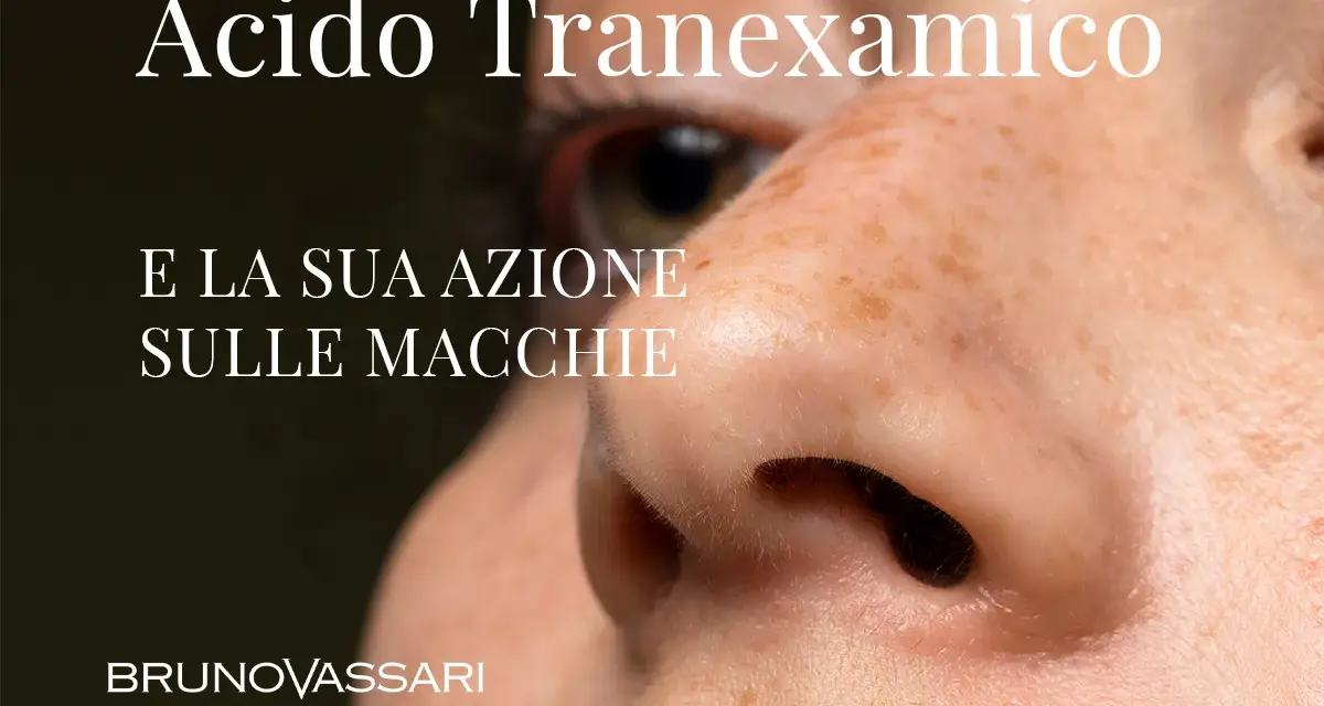 Acido Tranexamico: la sua azione sulle macchie della pelle. Bruno Vassari.