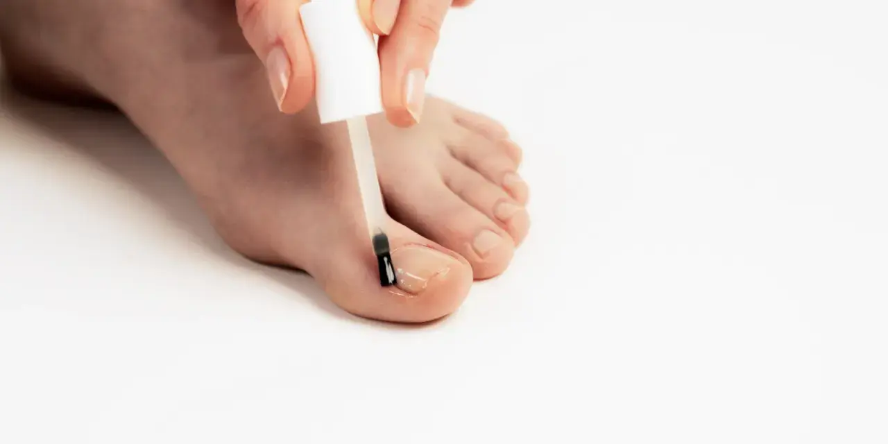 Application d'une huile essentielle sur un ongle incarné pour soulager la douleur et favoriser la guérison.