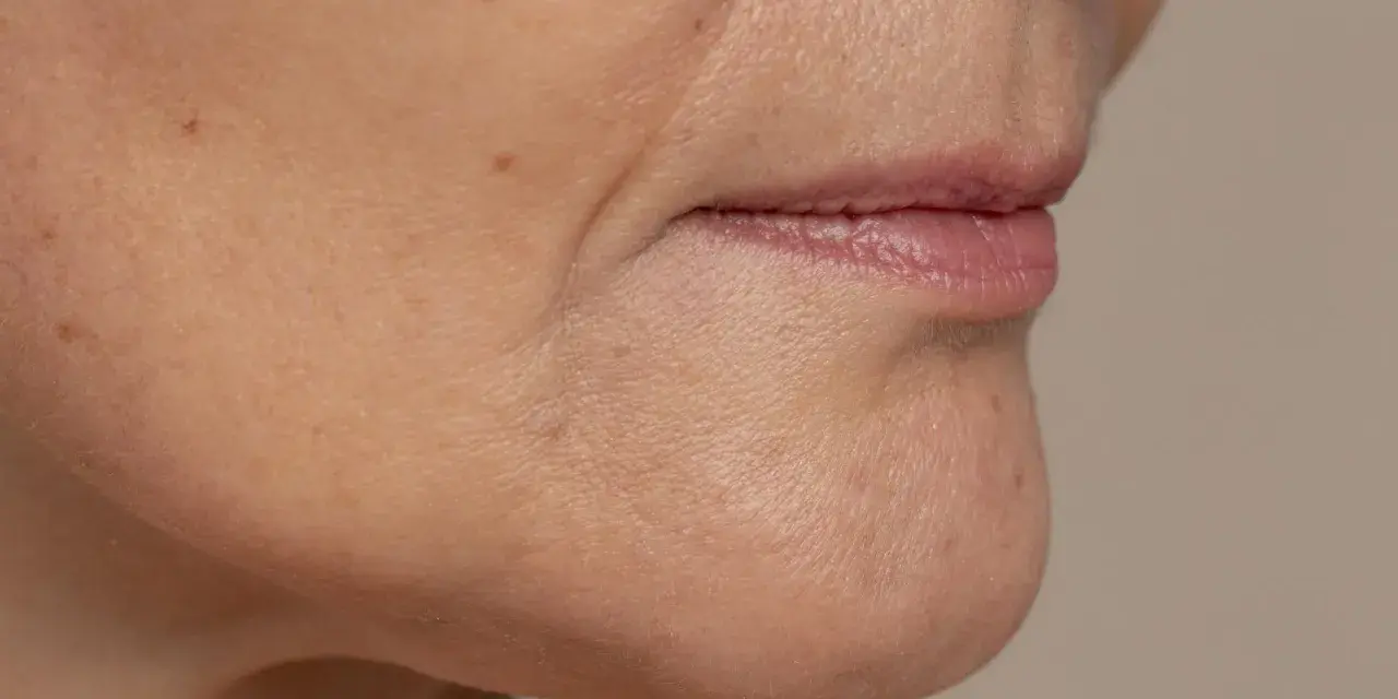 Primer plano de la zona de la barbilla y boca, mostrando la flacidez facial a los 40 y algunas pecas.