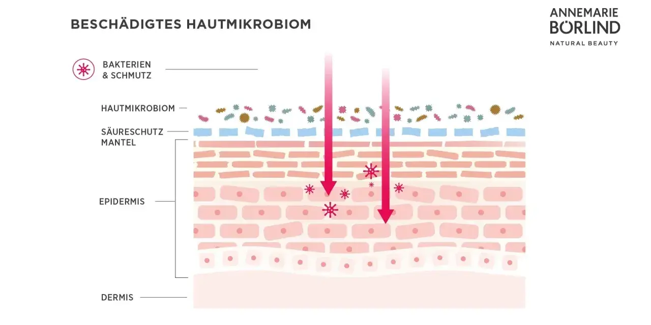 Illustration zeigt ein geschädigtes Hautmikrobiom mit Bakterien und Schmutz, die in die Epidermis eindringen.