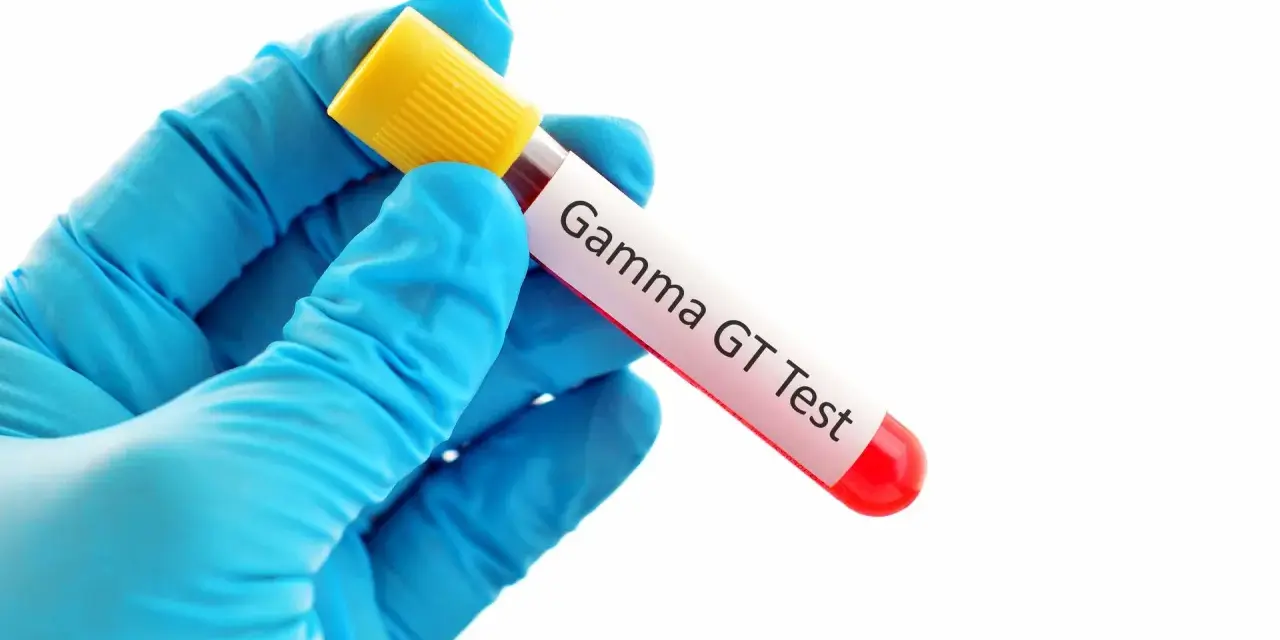 Rękawiczka w niebieskiej rękawiczce trzyma probówkę z krwią do badania Gamma GT. Wynik: ggtp podwyższone.