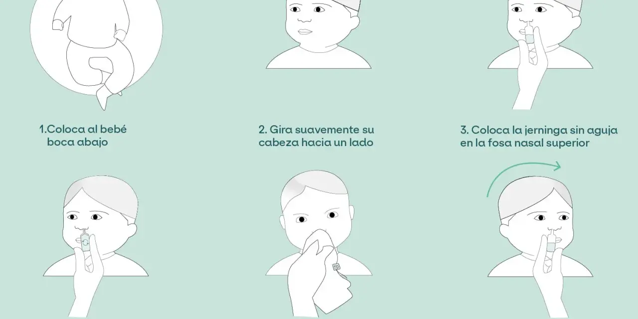 Ilustración paso a paso para el lavado nasal de un bebé. Incluye cómo colocarlo, girar su cabeza, usar la jeringa y limpiar su nariz.