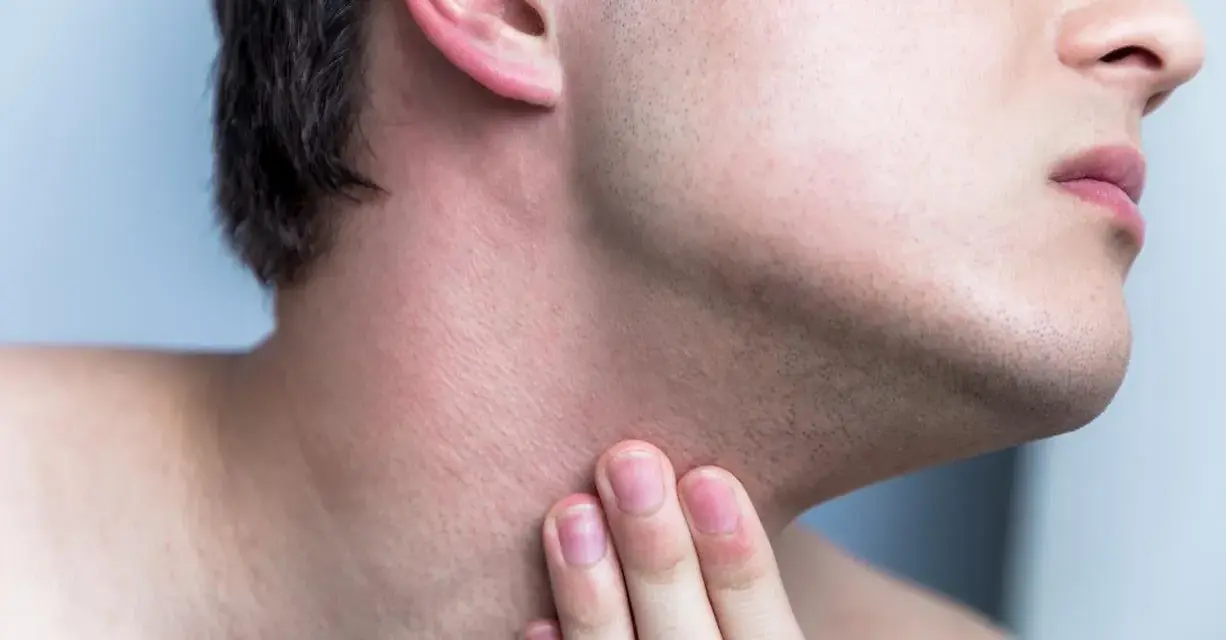 Hombre tocando su cuello con irritación y pequeños granos después de afeitarse.