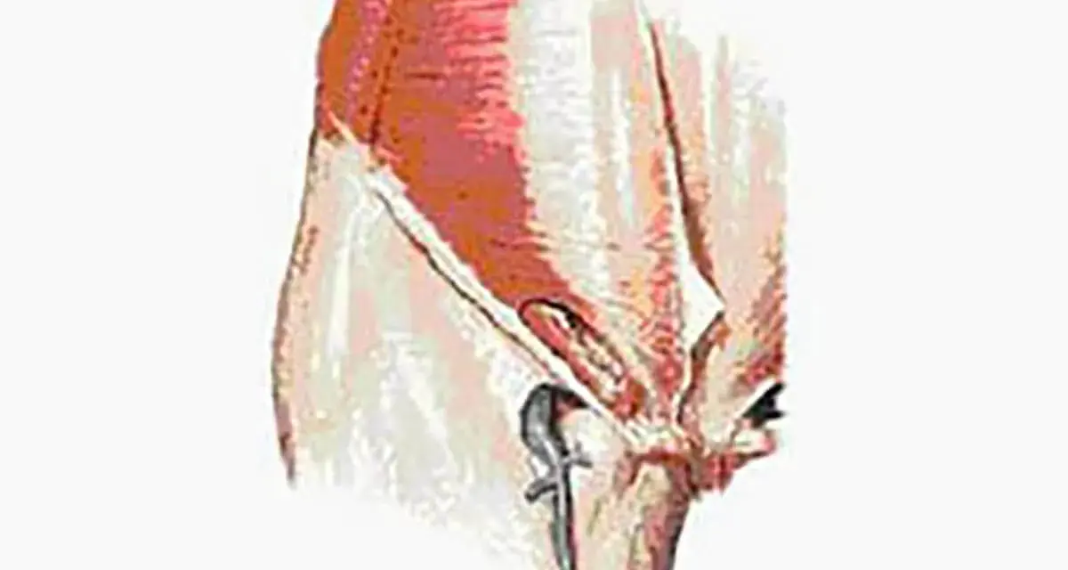 Illustration anatomique montrant la région pubienne, pertinente pour la pubalgie chez la femme.