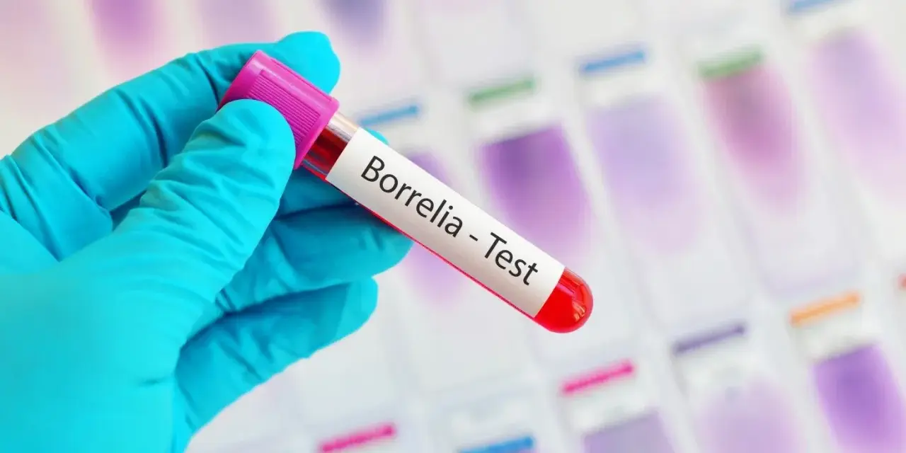 Ręka w niebieskiej rękawiczce trzyma probówkę z napisem "Borrelia - Test". To klucz do odpowiedzi, gdzie zrobić badania na boreliozę.