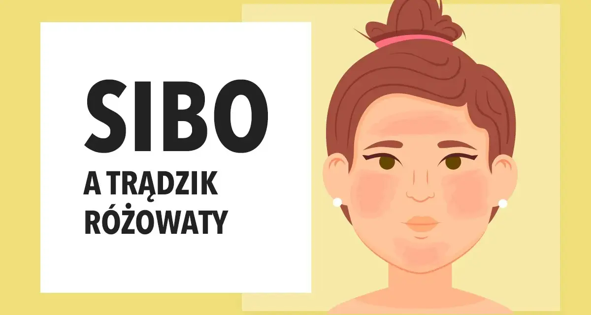 SIBO może objawiać się jako trądzik różowaty. Ilustracja przedstawia twarz z zaczerwienieniami na policzkach i nosie, sugerując problemy skórne.