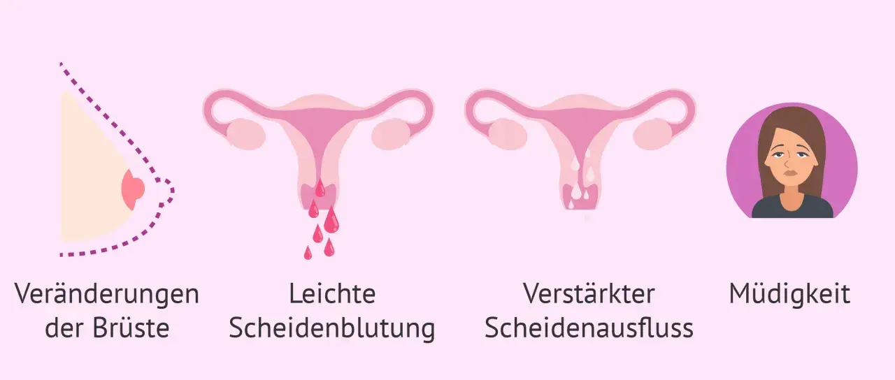 Brustveränderungen, leichte Blutungen, verstärkter Ausfluss und Müdigkeit können Anzeichen sein, dass die periode bleibt aus.