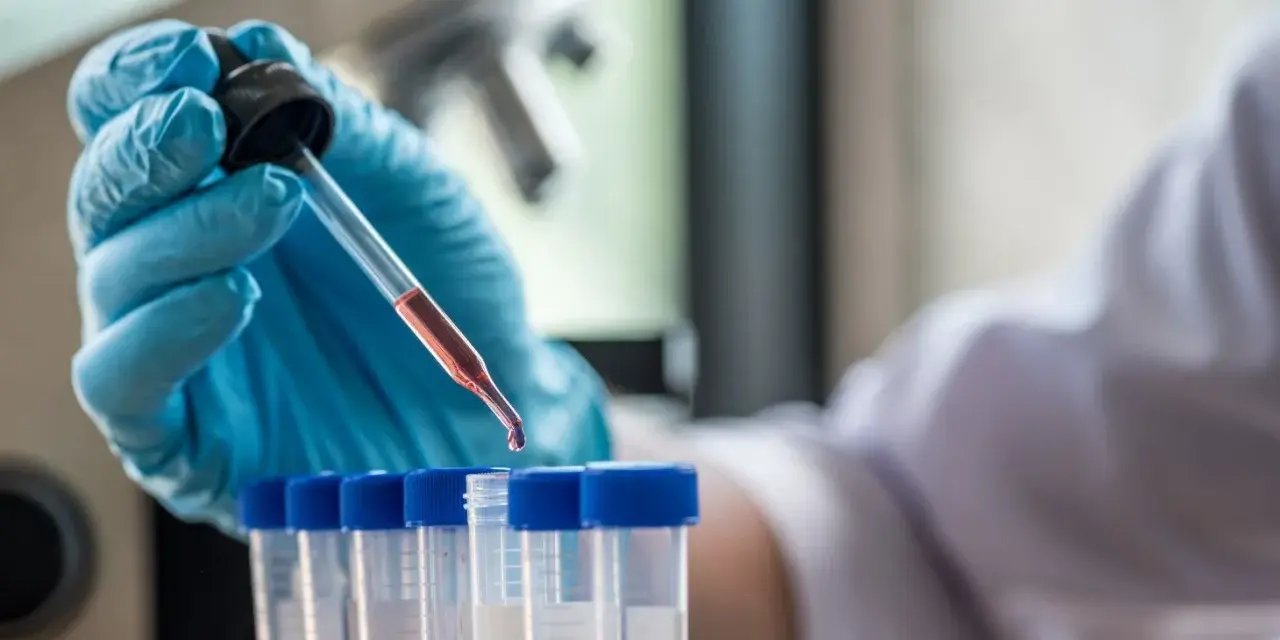 Laborant pobiera próbkę krwi do analizy. Dowiedz się, ile kosztuje test na HIV w laboratorium.