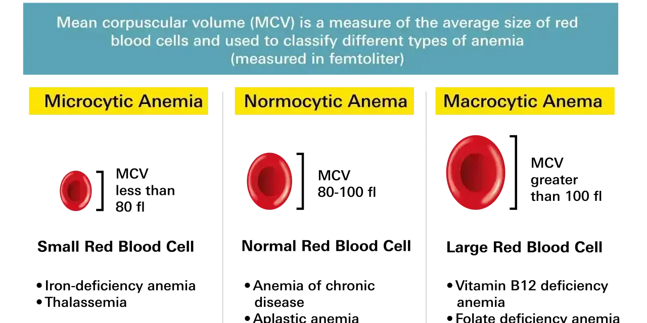 Anemia co to? Porównanie wielkości czerwonych krwinek: mikrocytarna (małe), normocytarna (normalne), makrocytarna (duże).