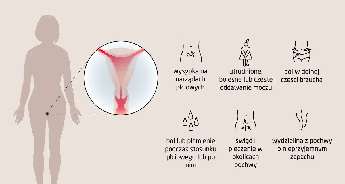 Ilustracja przedstawia sylwetkę kobiety z powiększeniem narządów płciowych i ikonami objawów infekcji.