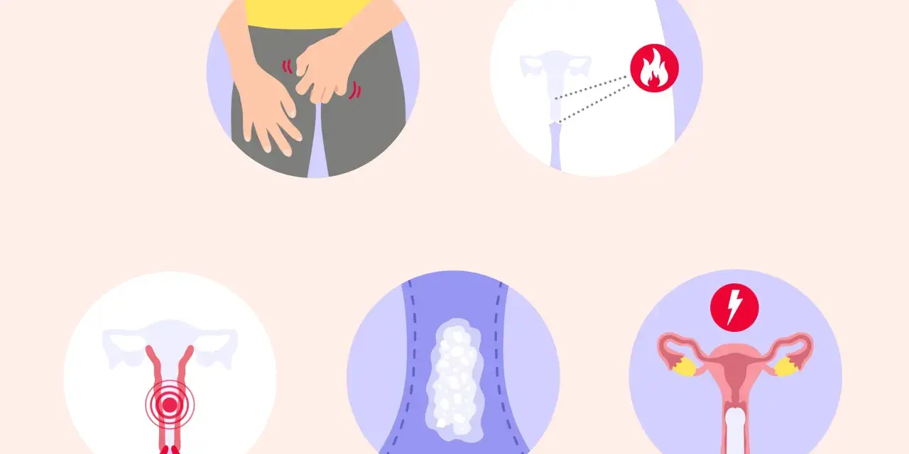 Illustrationen zeigen Juckreiz im Intimbereich, Entzündungssymptome, Ausfluss und Schmerzen. So sieht scheidenpilz aus.