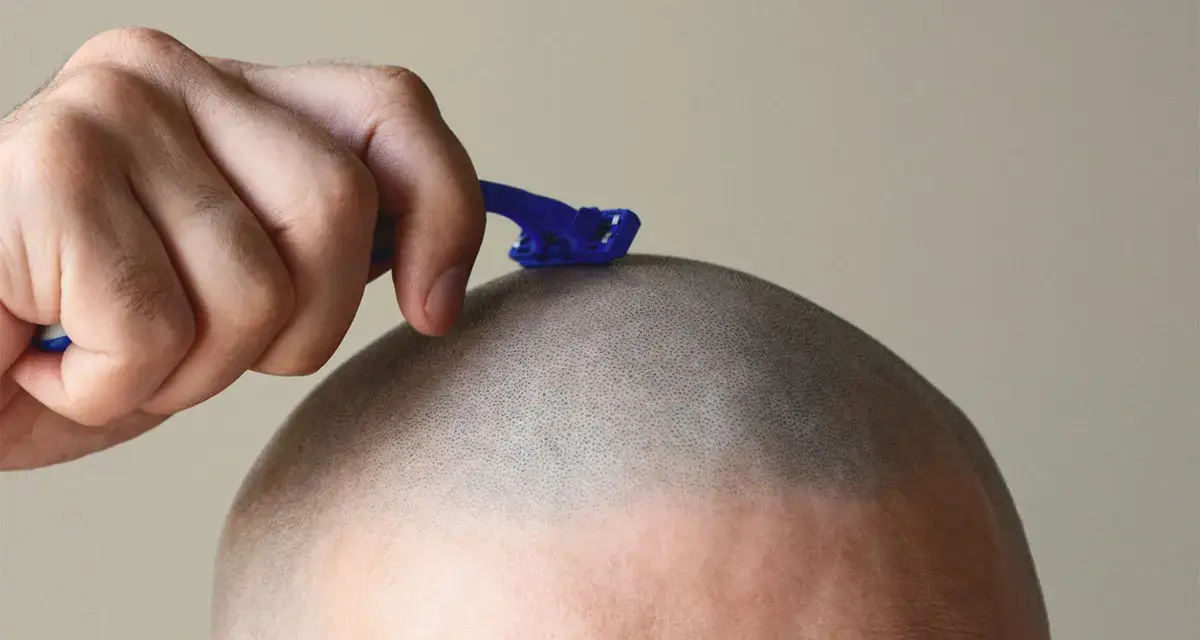 Mano con maquinilla azul afeitándose la cabeza, dejando la piel suave y sin vello.