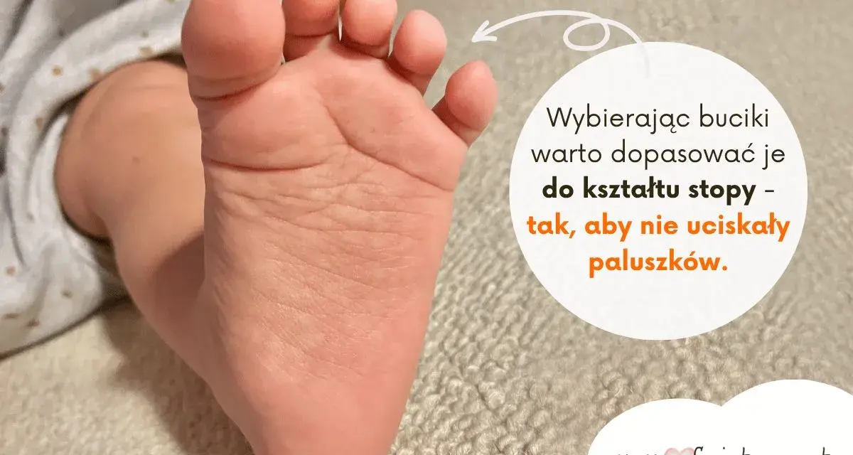 Dziecięca, szeroka stopa z widocznymi paluszkami. Tekst radzi dopasować buciki do kształtu stopy, by nie uciskały paluszków.