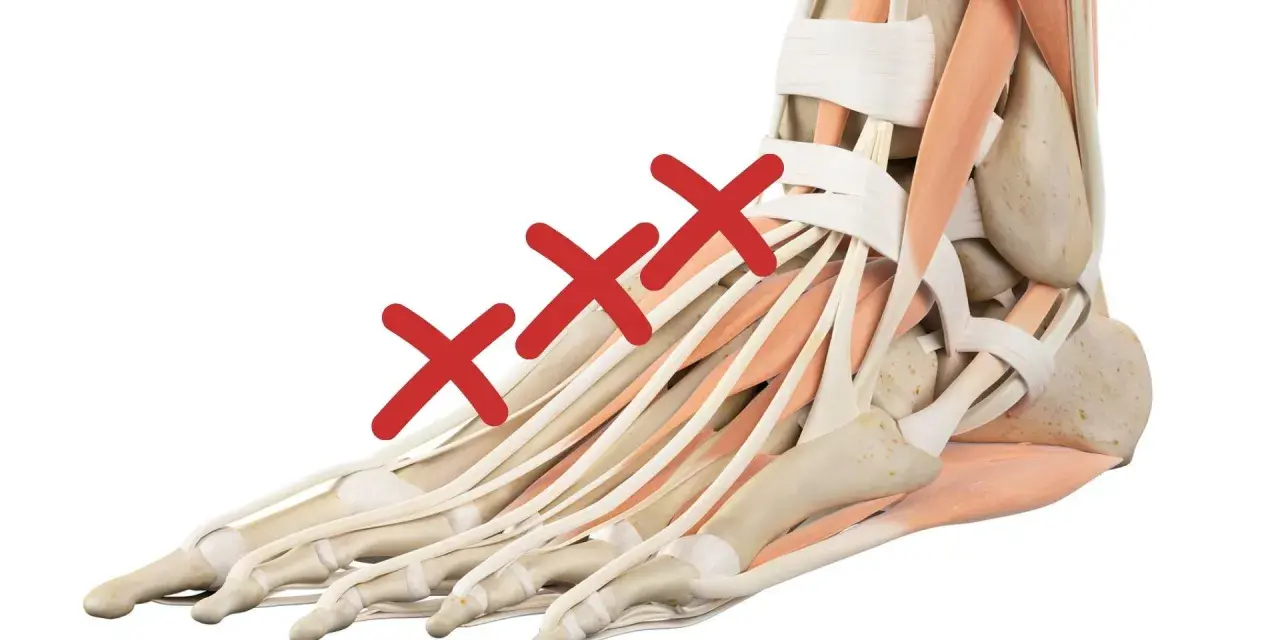 Anatomia del piede con tre croci rosse sui tendini, indicando un problema come il collo del piede gonfio.