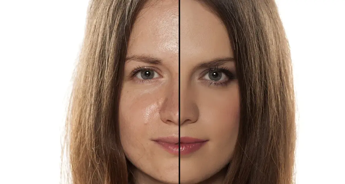 Viso diviso: a sinistra pelle con sebo e imperfezioni, a destra pelle uniformata dal trucco.