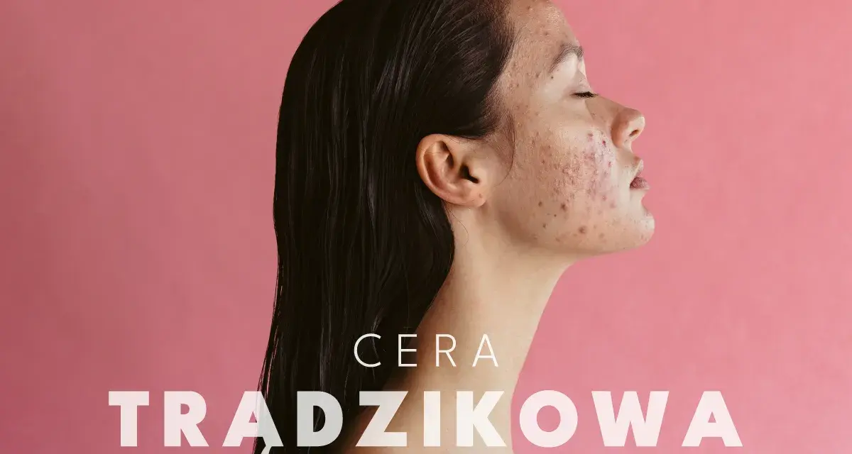 Profil kobiety z cerą trądzikową. Dowiedz się, jak dbać o cerę trądzikową i odzyskać jej zdrowy wygląd.