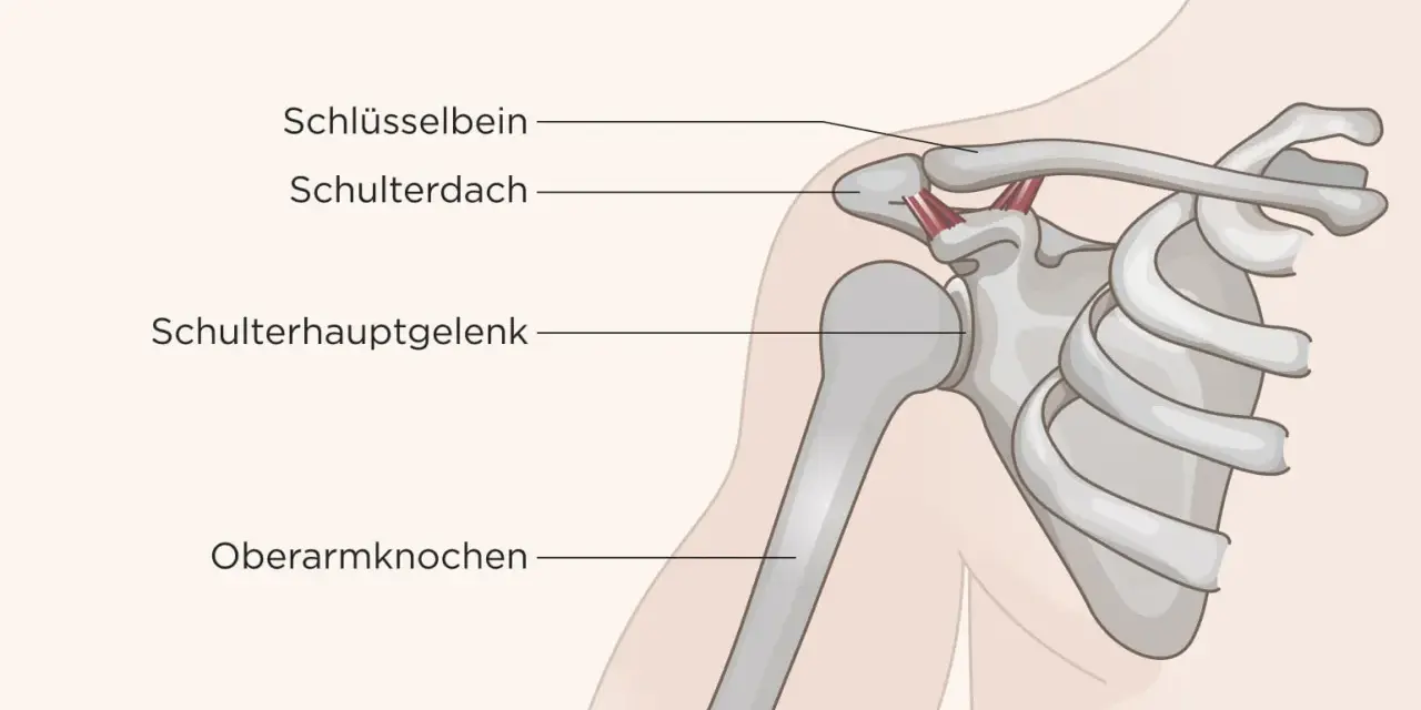 Anatomie der Schulter: Schlüsselbein, Schulterdach, Schulterhauptgelenk und Oberarmknochen. Die Heilung des Schulter-Arm-Syndroms kann variieren.