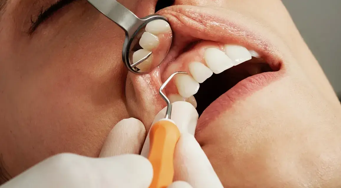 Znieczulenie u dentysty w ciąży: Bezpieczne leczenie dla mamy i dziecka