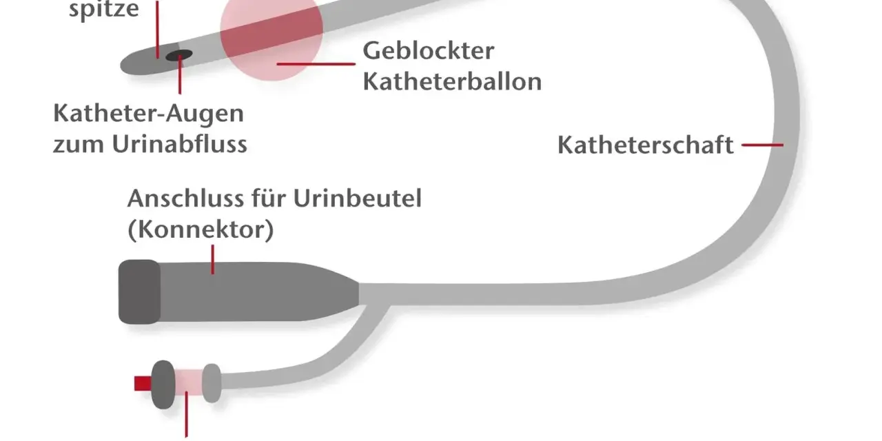 Schema eines Blasenkatheters mit Nélaton-Spitze, Ballon und Anschluss für Urinbeutel. Wer darf Katheter legen? Geschultes medizinisches Personal.