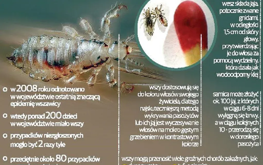 Czy farba zabija wszy? Prawda o gnidach i bezpieczne leczenie