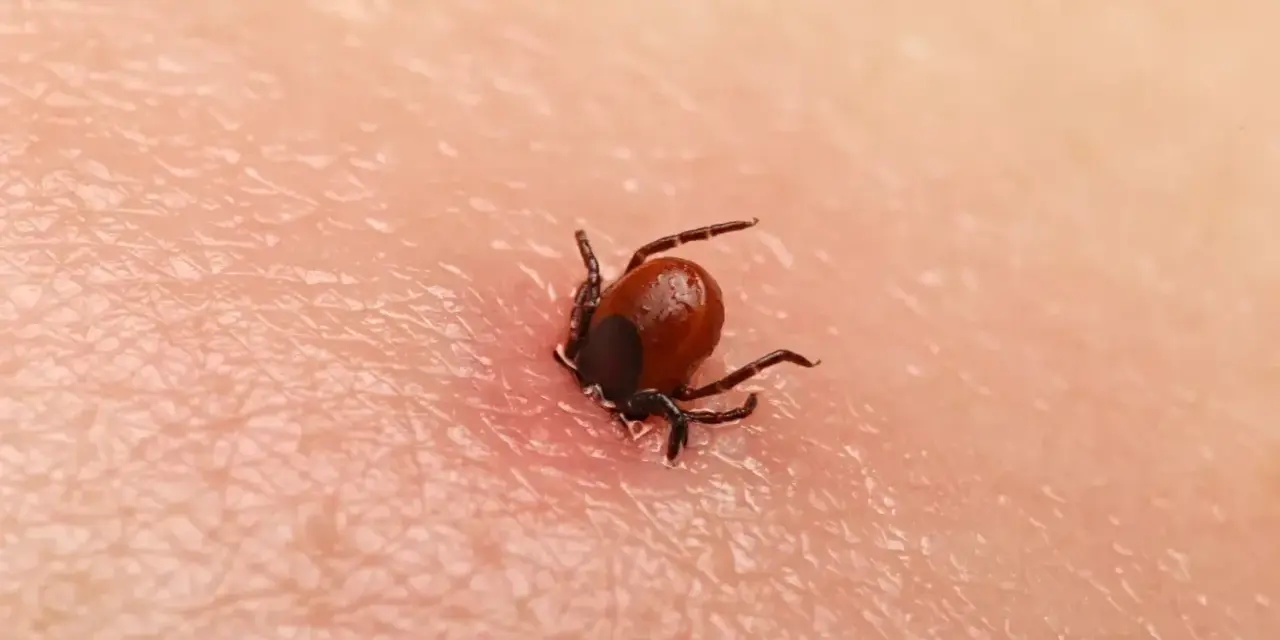 Jak bezpiecznie wyciągnąć kleszcza? Poradnik krok po kroku