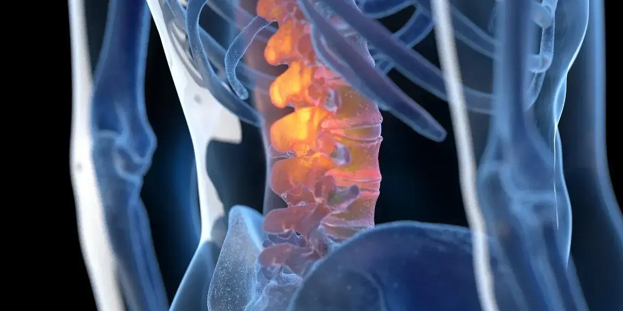 Anatomical rendering of a human spine with inflamed vertebrae, highlighted in orange and red.