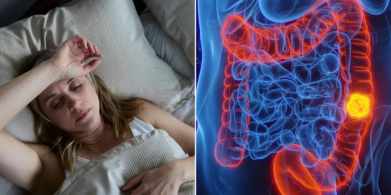 Frau im Bett, besorgt. Daneben eine 3D-Darstellung des Darms mit einem leuchtend gelben Tumor. So fing Darmkrebs an.