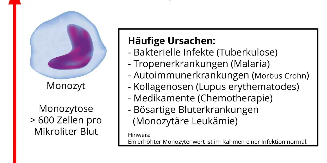 Erhöhte Monozyten (Monozytose) können auf Infektionen, Autoimmunerkrankungen oder Leukämie hinweisen. Der Normwert liegt bei 285-500 Zellen/µl.