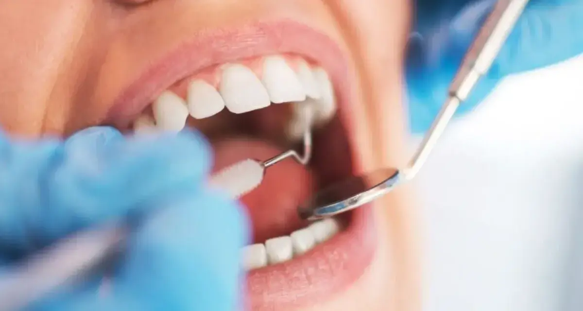 Dentysta wykonuje sanację jamy ustnej, używając lusterka i szczoteczki do czyszczenia zębów.