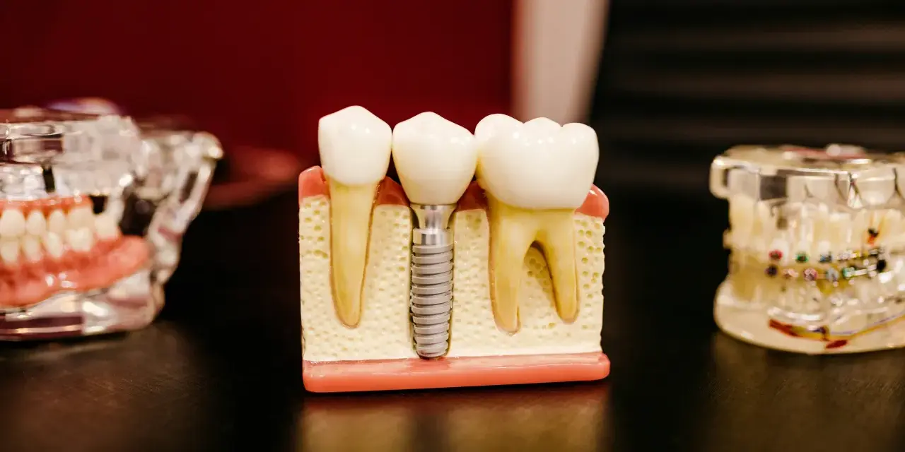 Stomatolog Lublin – kiedy warto zmienić dentystę i na co realnie zwrócić uwagę przy wyborze gabinetu
