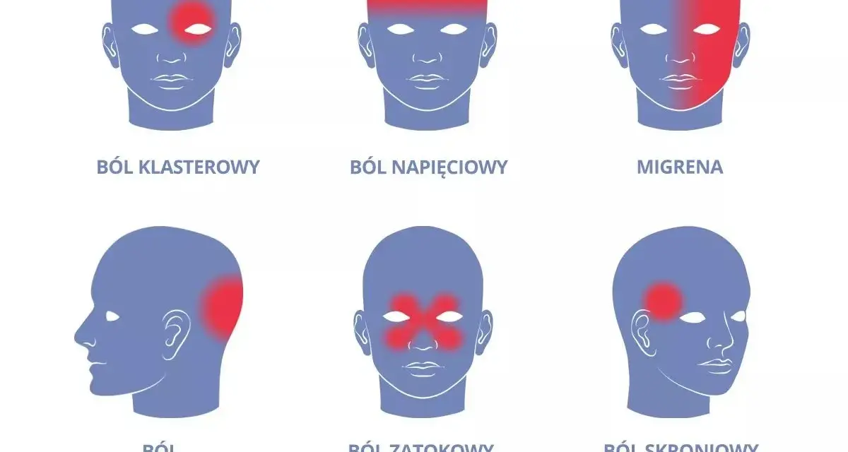 Ilustracja pokazuje różne rodzaje bólu głowy: klasterowy, napięciowy, migrenę, szyjnopochodny, zatokowy i skroniowy.
