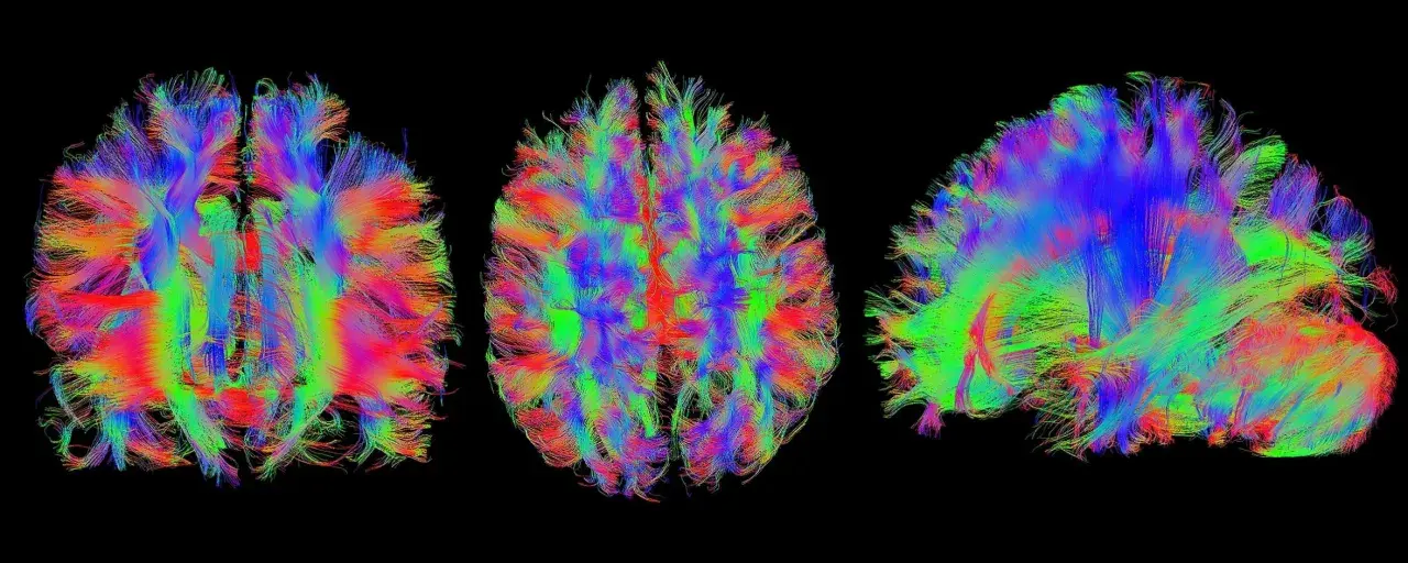 Bunte Faserbahnen des Gehirns, die die komplexen Verbindungen für kognitive Wissenschaft darstellen.