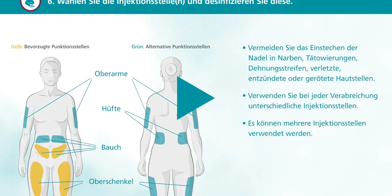 Illustration zeigt bevorzugte (gelb) und alternative (grün) Injektionsstellen am Körper, z.B. Oberschenkel.