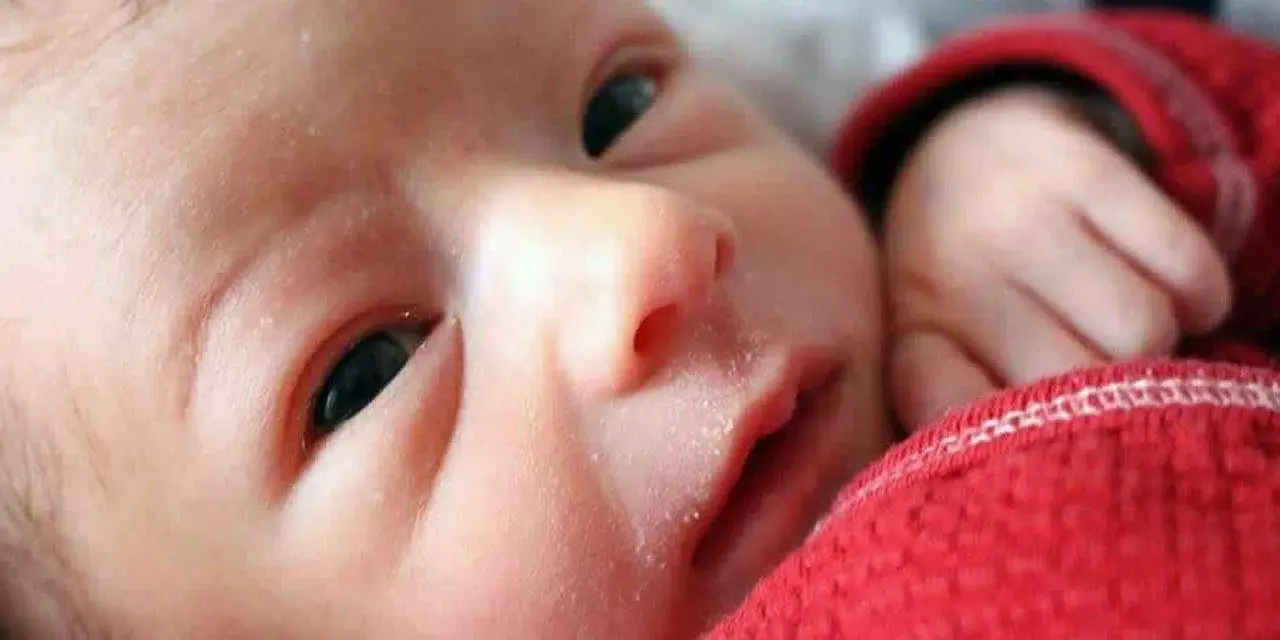 Primo piano del viso di un neonato con crosta lattea. La sua manina è appoggiata su una coperta rossa.