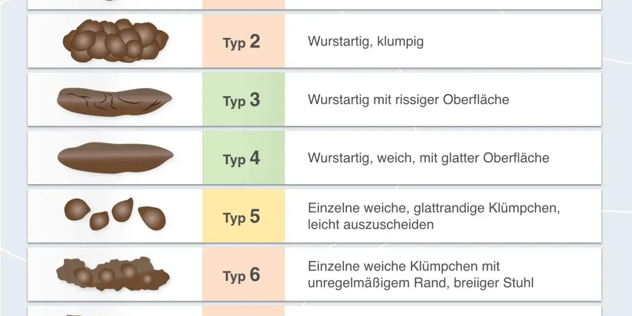 Stuhlformen von Typ 1 (hart, klumpig) bis Typ 7 (flüssig). Bei keinem Stuhlgang ab wann bedenklich? Die Grafik zeigt verschiedene Stuhltypen.