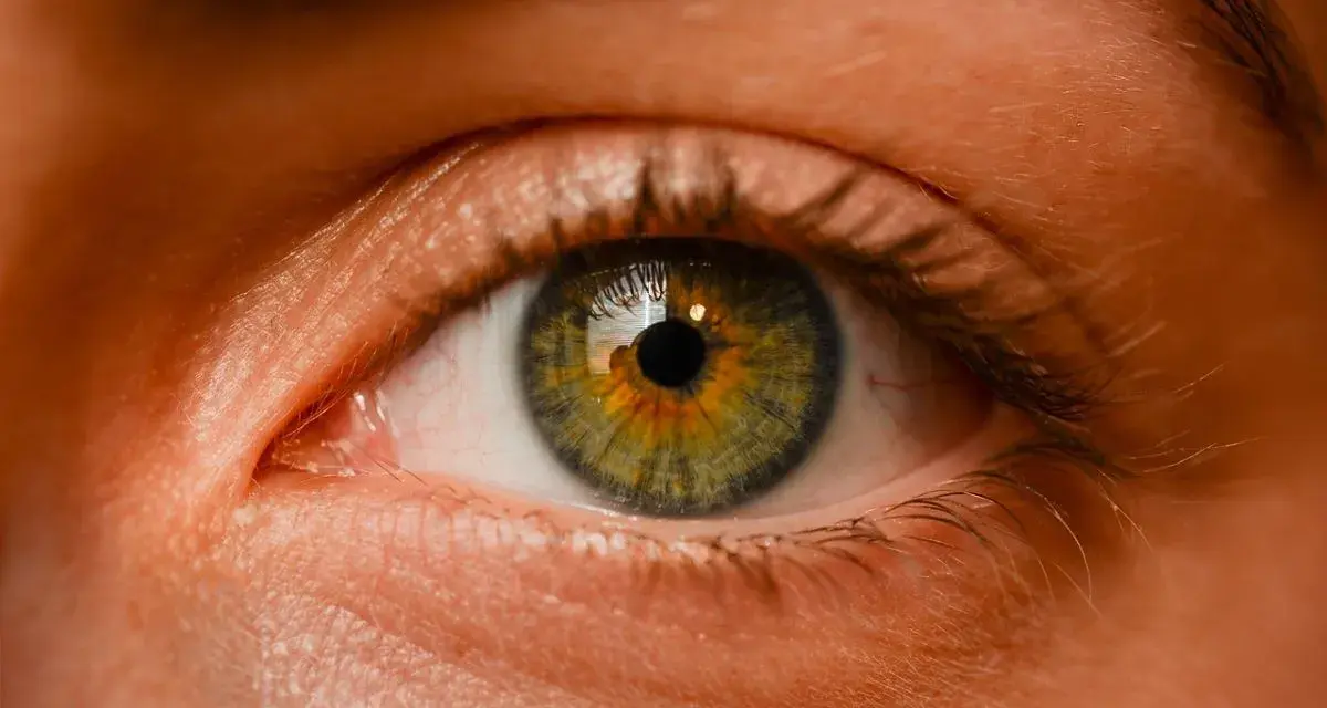 Occhio con iride verde-ambra, riflessi nella pupilla. Potrebbe essere un'immagine legata a iniezione intravitreale effetti collaterali.