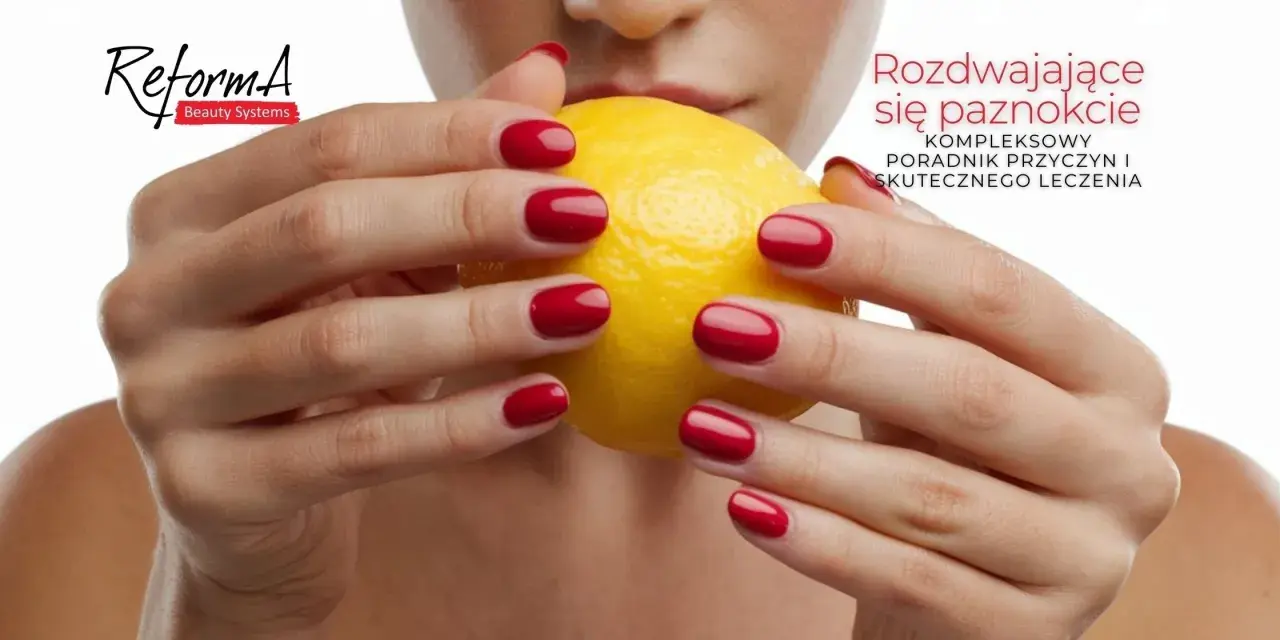 Dłonie z czerwonymi paznokciami trzymają cytrynę. Tekst informuje o rozdwajaniu się paznokci i sposobach leczenia.