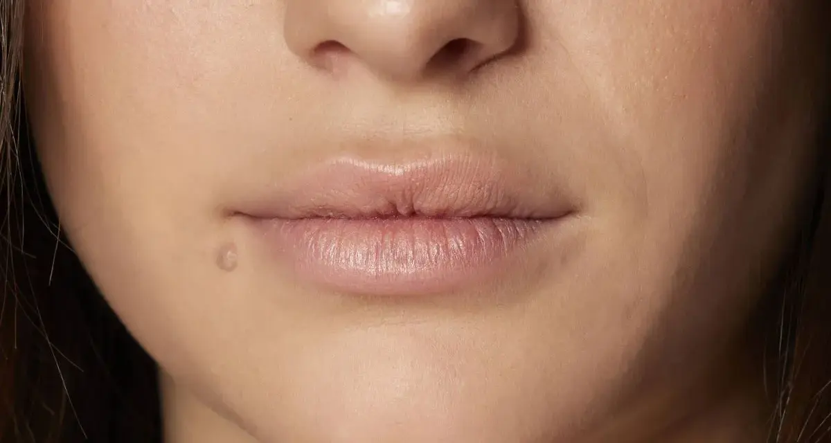 Labios con una pequeña marca, buscando un remedio casero para labios cortados.